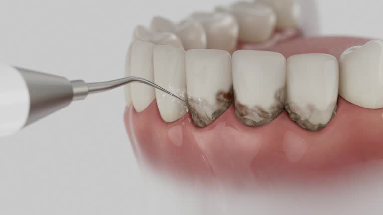 Trusted Wisdom Tooth Removal service in Wynne, AR - Dentist Open Now